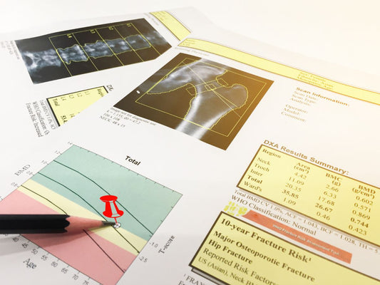 Bone Density Scan AND Office Office