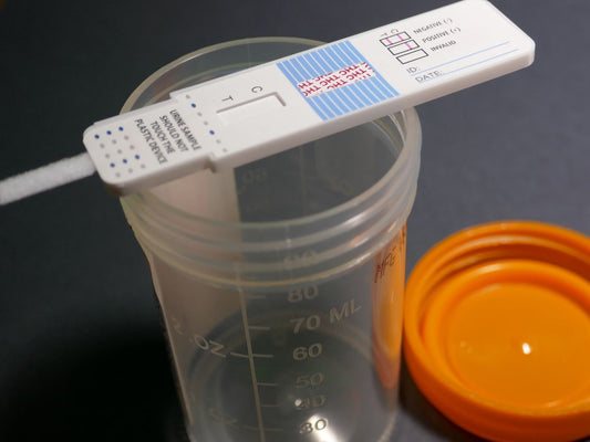 Urine Drug Screen