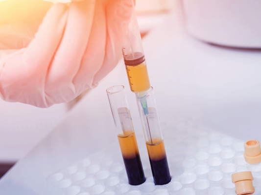 PRP Lichen Sclerosis – Focal Area (1 Vial)