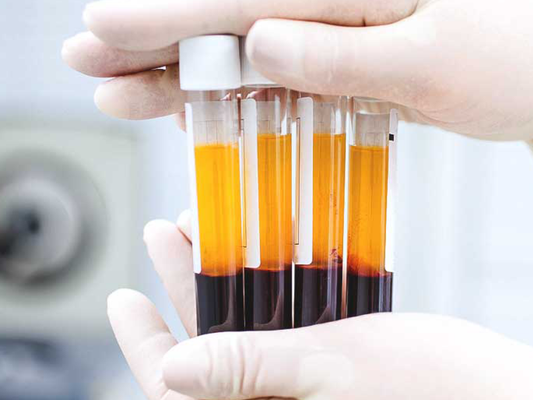 PRP Lichen Sclerosis – Extensive Area (2 Vials)