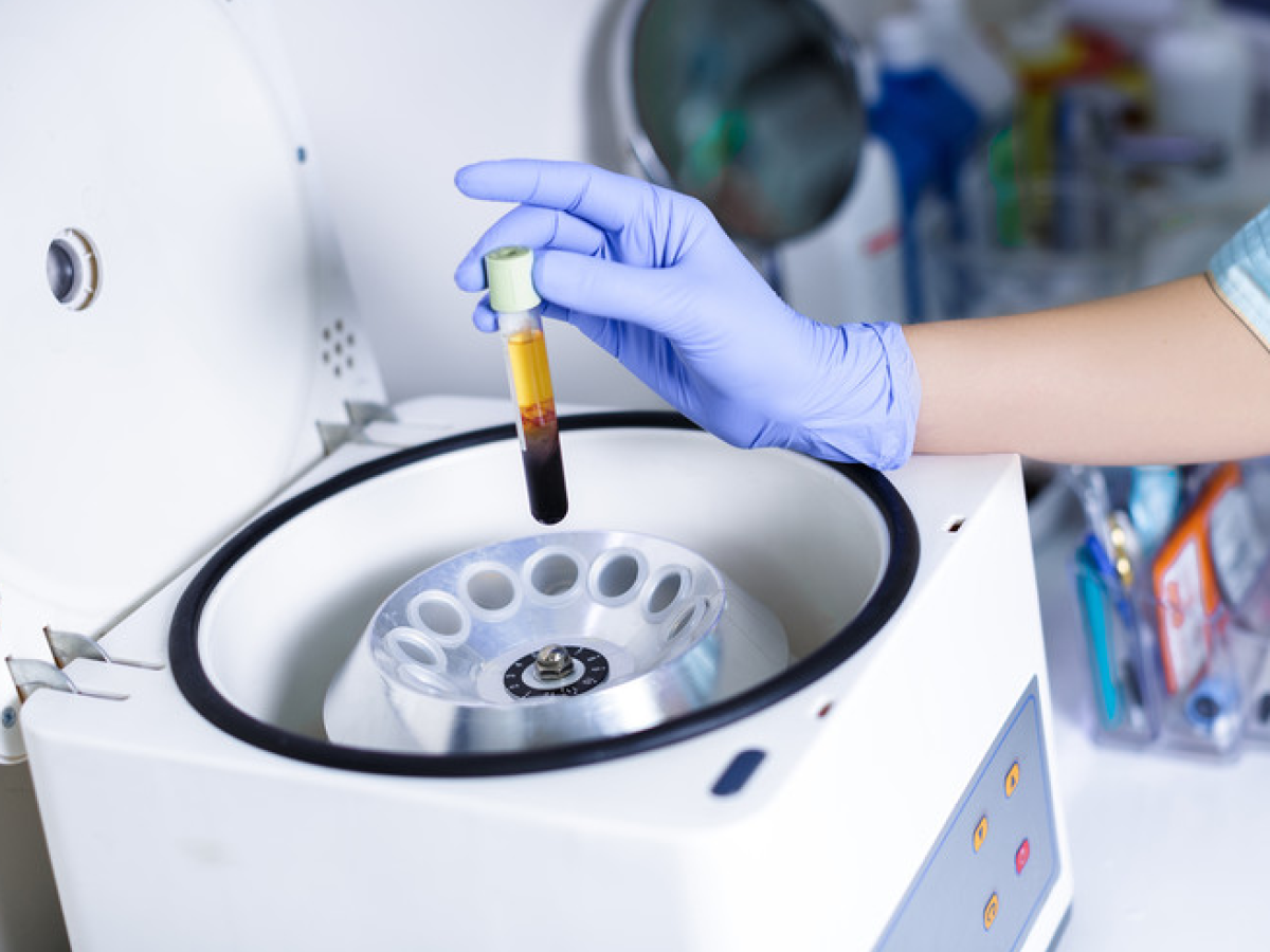 PRP – Other Treatment – 1 Vial