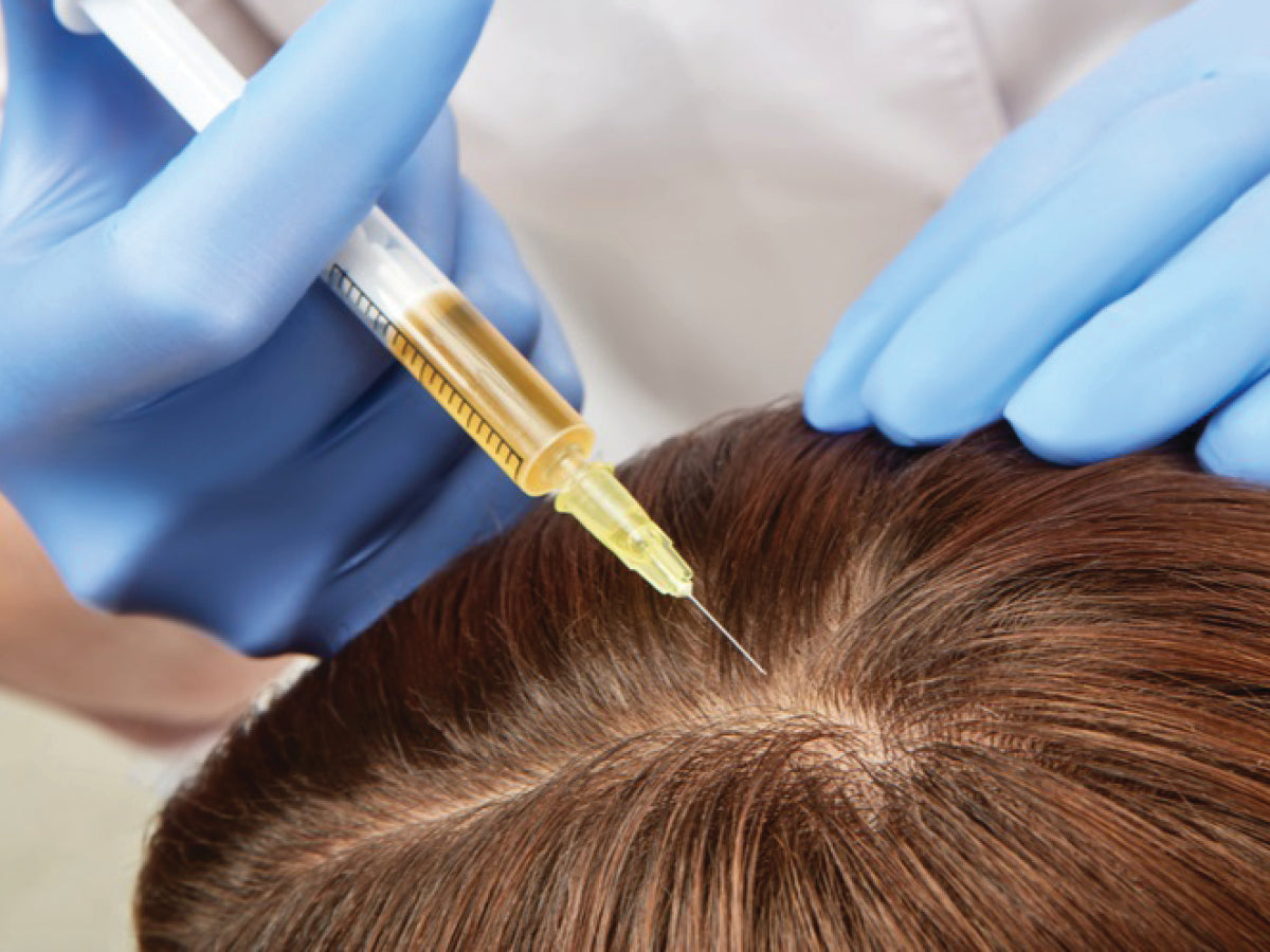 PRP Hair Restoration – 2 Vials